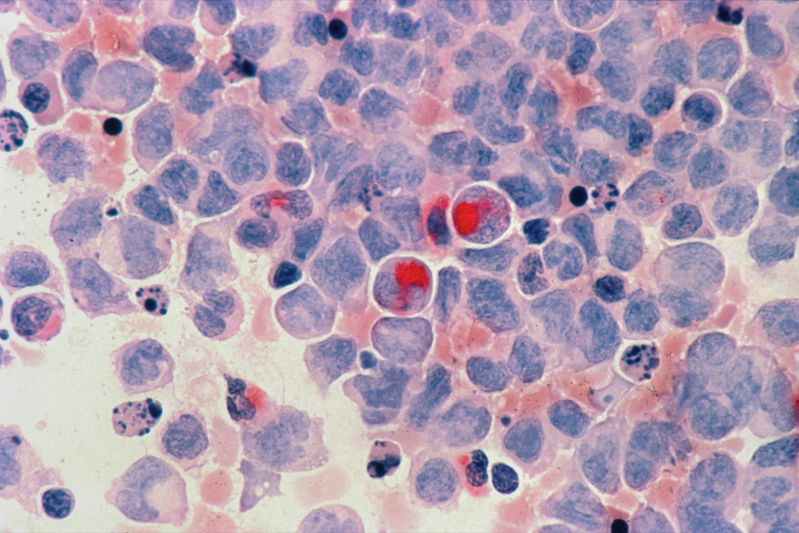 Microscope view of stained cells in a tissue sample